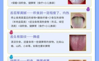 新生儿舌苔厚白是何原因？