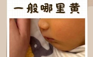月子新生儿黄疸为何总反复？到底该如何科学应对？