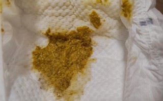 新生儿拉粑粑带血丝是上火还是肠道出问题了？