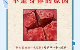 孕期额头频冒痘痘，该如何安全护理又不伤胎儿？