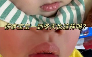 新生儿下嘴唇老颤抖是怎么回事