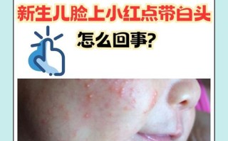新生儿脸上有小红斑点是正常现象还是需要警惕的健康信号？