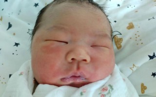 新生儿直接胆红素86μmol/L需要立即干预吗？