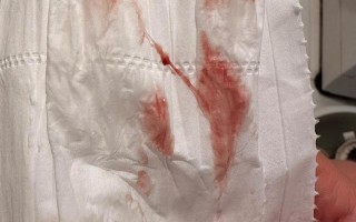 孕期妇科炎症引发流血，会对胎儿造成哪些不良影响？