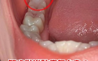 孕期智齿冠周炎疼得睡不着，不治疗会影响胎儿吗？