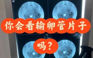 备孕期间意外拍了X片，孩子还能要吗？辐射影响有多大？