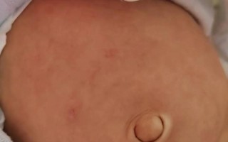 新生儿肚子总咕噜响是正常还是消化问题？