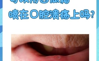 备孕期间可以喷西瓜霜吗