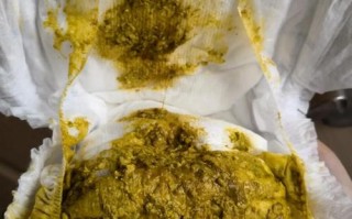 新生儿母乳喂养出现蛋花状大便，是消化异常还是正常现象？