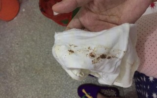 备孕期出现褐色分泌物是正常现象吗？需要立即就医检查吗？