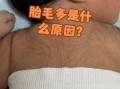 新生儿胎毛重什么原因