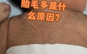 新生儿胎毛重什么原因