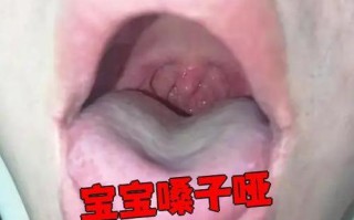 新生儿喝奶后喉咙响是正常现象还是异常信号？需警惕哪些潜在问题？