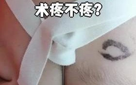 新生儿泪道探通术视频全过程安全吗？家长观看前需了解哪些注意事项？