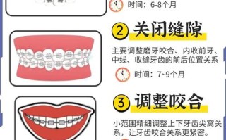 备孕期间矫正牙齿安全吗？对孕期及胎儿健康有潜在影响吗？