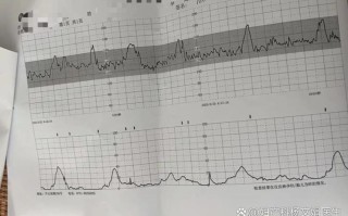 孕期刺激乳头真的会导致宫缩吗？对胎儿会有影响吗？
