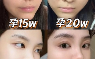 孕期眉毛变淡真能判断生男生女？科学依据是什么？