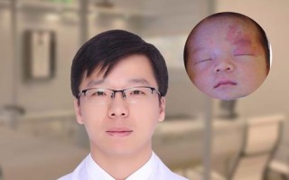 新生儿花斑纹会影响健康发育吗？需要干预治疗吗？