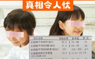 新生儿血小板低，原因后果如何？