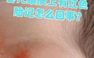 新生儿上眼皮发红是何原因？