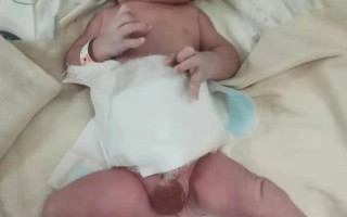 新生儿小蛋蛋发黑是正常现象吗？需要担心哪些健康问题？