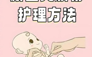 如何护理新生儿的肚脐
