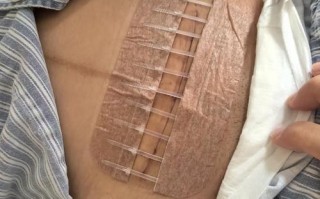 怀孕期间小腹韧带拉伤是怎么回事？该怎么缓解和预防？