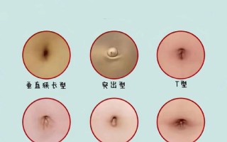 正常新生儿的肚子应该是什么样？不同状态下的图片差异大吗？