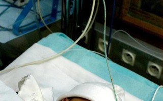 新生儿重度缺氧后遗症能否早期干预减轻脑损伤程度？