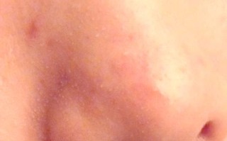 怀孕期间鼻子特别敏感，是激素变化捣的鬼吗？