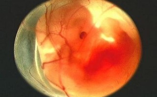 孕期出现哪些信号可能提示怀了唐氏宝宝？需要做哪些检查来排查？