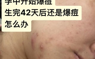 孕期痘痘频发，激素变化还是其他原因？