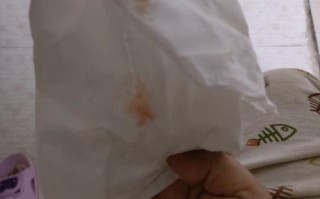 孕期同房后有少量出血