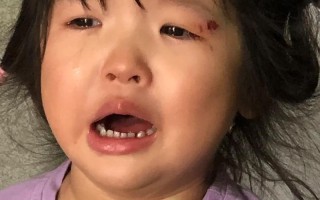 新生儿哭时嘴歪是面瘫吗？如何判断与处理？