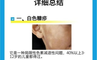 新生儿脸小白点是啥？需治吗？