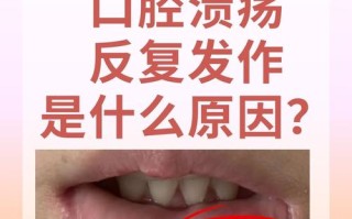 儿童反复口腔溃疡警惕哪五种病？