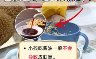 孕期吃酱油会让宝宝皮肤变黑吗？