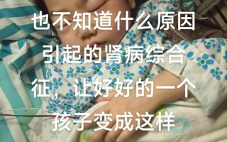 儿童肾虚的常见症状有哪些？家长该如何辨别与应对？