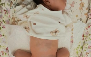 新生儿皮肤为何会呈现青紫色？这正常吗？背后的生理机制是什么？