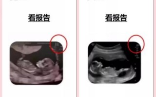 孕期如何鉴定孩子生父？