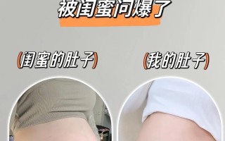 孕期没长纹，产后会突然冒出来吗？