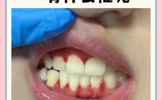 孕期一睡觉就牙龈出血，是正常现象还是身体在发出预警信号？