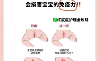 新生儿屁屁发红有红点咋办？