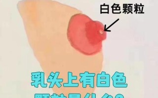 孕期乳头出现白色分泌物是正常现象吗？需要处理吗？