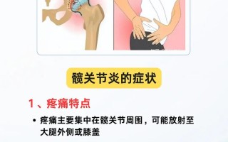 儿童胯骨疼是成长必经阶段还是隐藏疾病信号？需警惕哪些潜在原因？