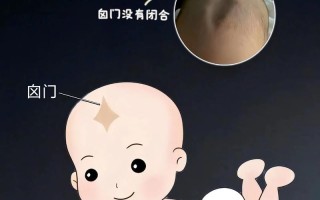 新生儿囟门偏小是发育异常还是个体差异？需警惕哪些潜在风险？