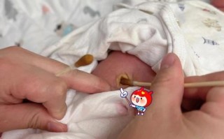 新生儿脐带20天未脱落是异常情况吗？需要采取什么措施？