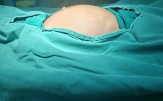 儿童便秘腹部摸到硬块是粪便堆积还是其他疾病信号？