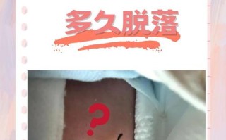 新生儿脐带脱落的征兆