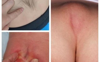 新生儿屁眼后的小坑是正常生理结构吗？需要特别护理或担心异常吗？